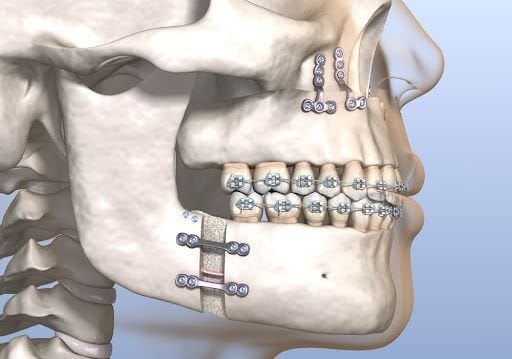 Oral & Maxillofacial Surgery
